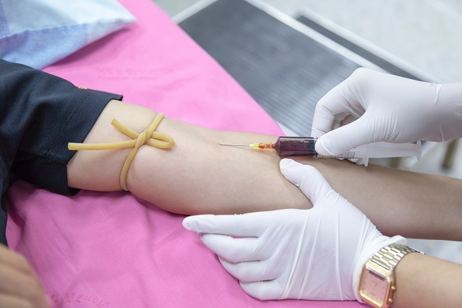 ACTUALIZACIÓN DE CONOCIMIENTOS EN PATOLOGÍA HEMOSTÁTICA Y TRASTORNOS DE COAGULACIÓN, POR EL TÉCNICO LABORATORIO DE DIAGNÓSTICO CLÍNICO (**) (75 horas)